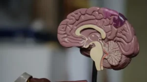 Image of a brain