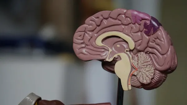 Image of a brain